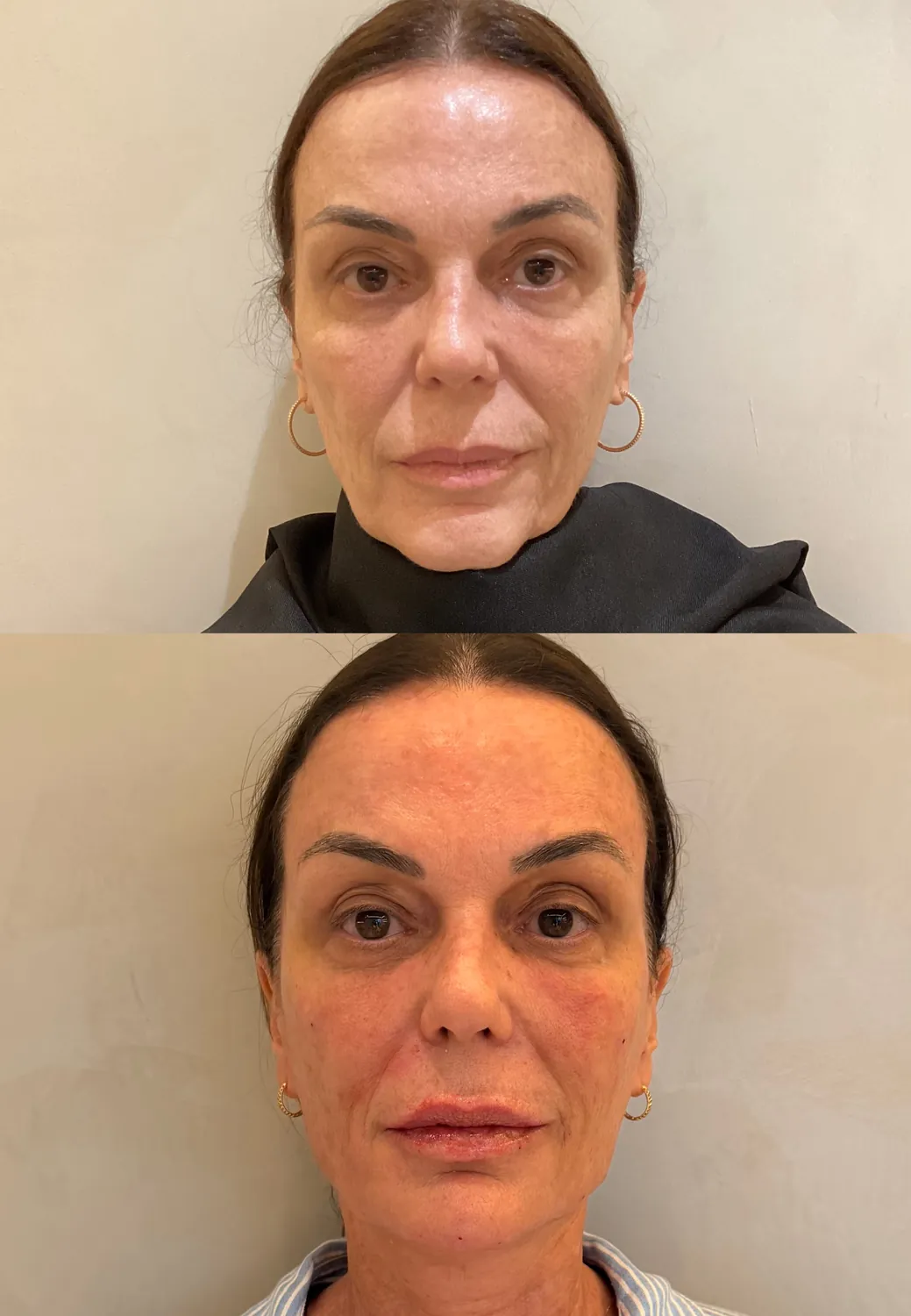 Antes e depois de paciente do Instituto, resultado 3