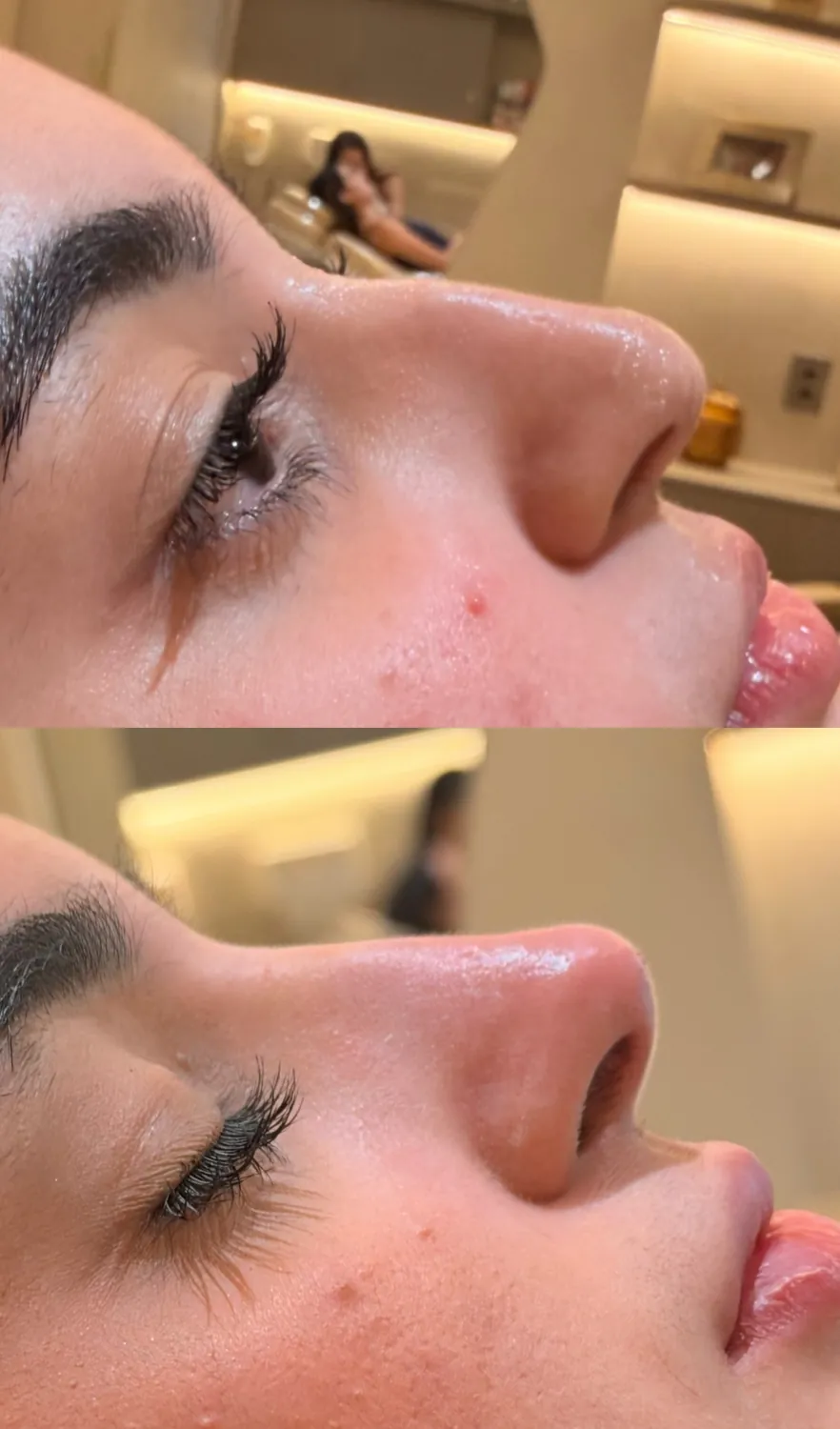 Antes e depois de paciente do Instituto, resultado 4