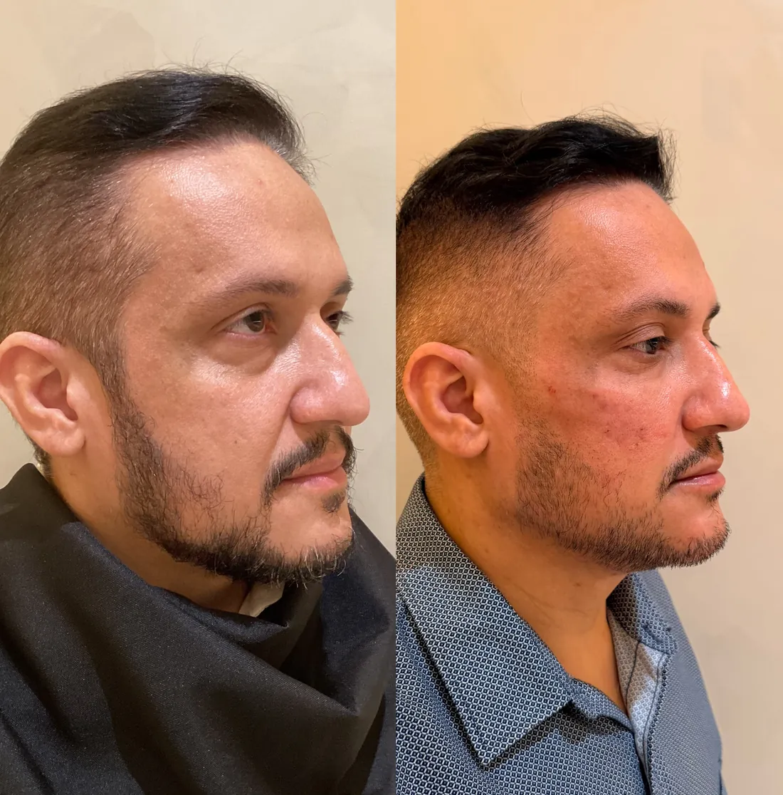 Antes e depois de paciente do Instituto, resultado 5