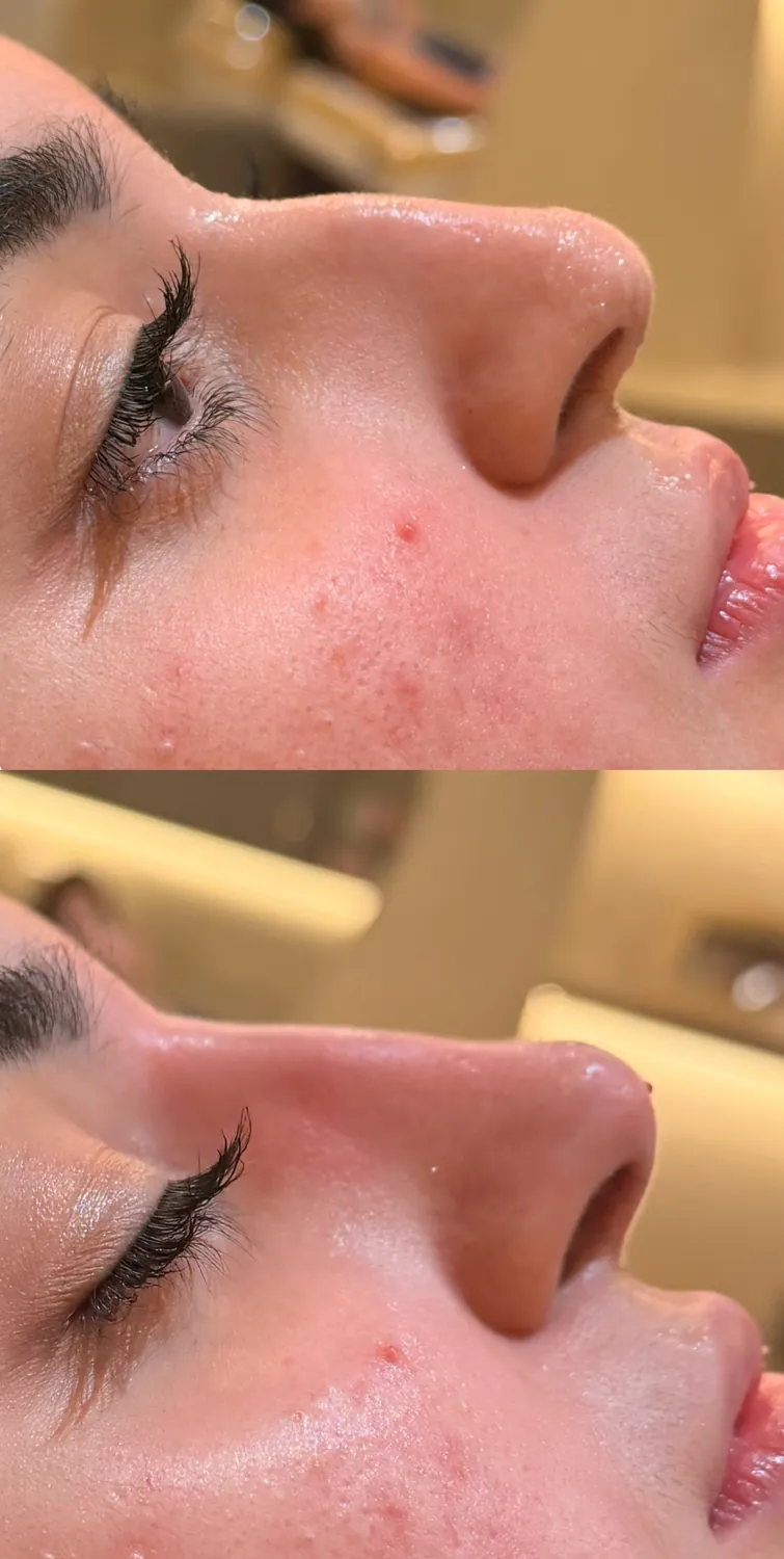 Antes e depois de paciente do Instituto, resultado 6