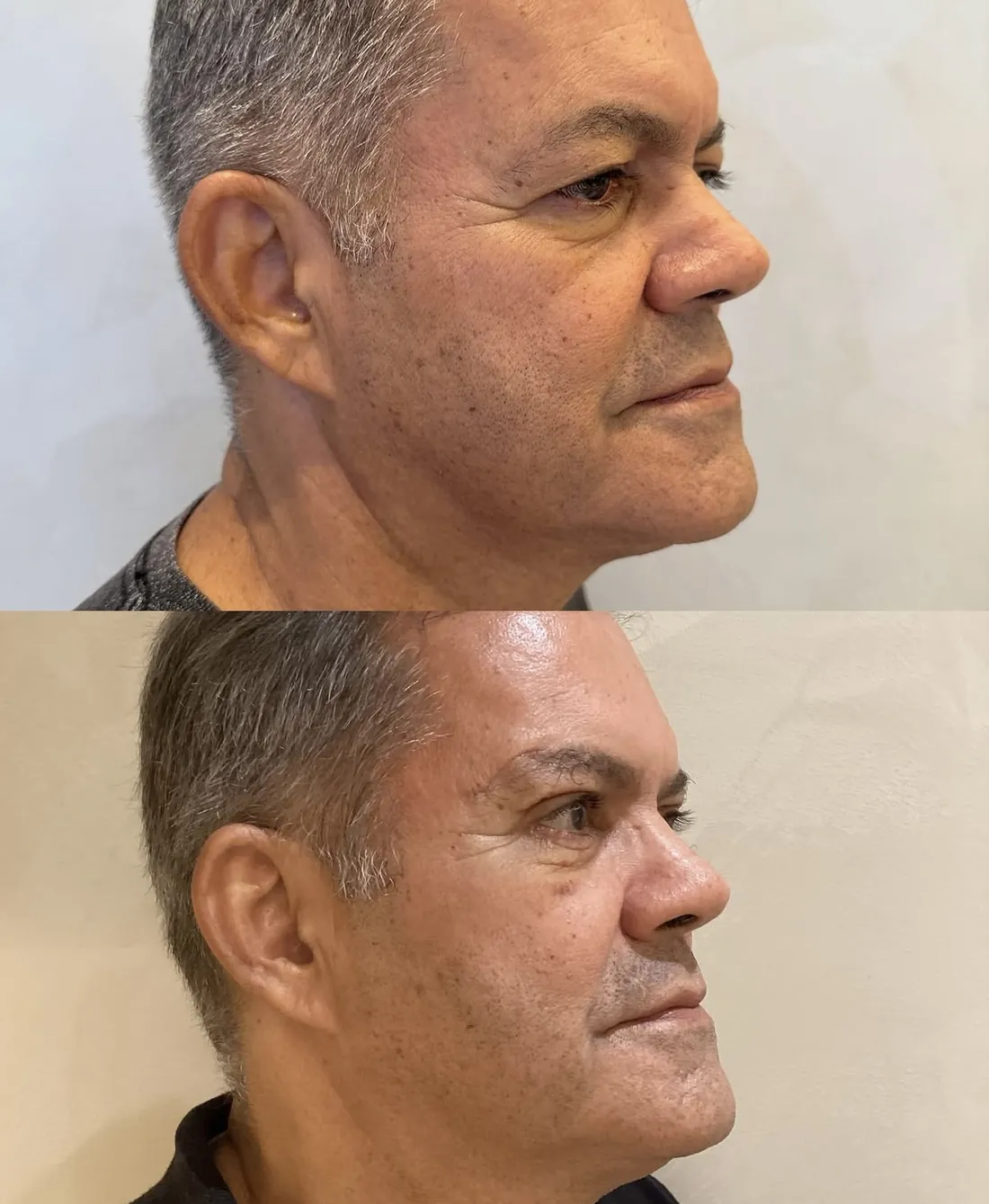 Antes e depois de paciente do Instituto, resultado 7